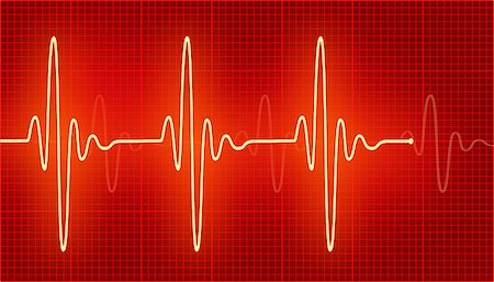 Bright cardiogram waves on the red. Stock Photo - Budget Royalty-Free & Subscription, Code: 400-08432206