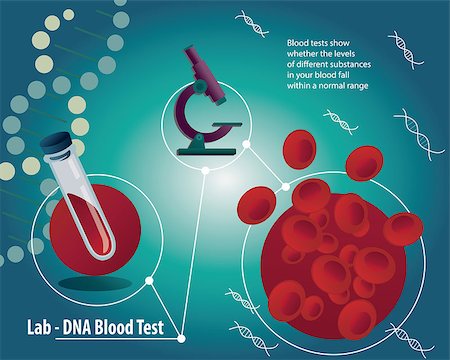 Blood test poster with medical laboratory equipment. Erythrocytes in the blood or RBCs for blood analises with microscope, DNA on blue background Stock Photo - Budget Royalty-Free & Subscription, Code: 400-08612596