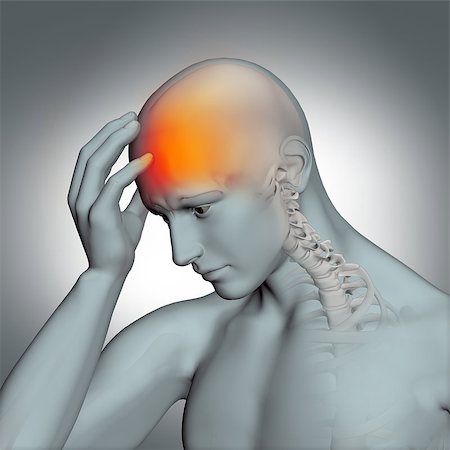 3D male medical figure holding head in pain Photographie de stock - Aubaine LD & Abonnement, Code: 400-08648463
