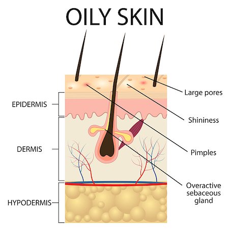 skin treatment medical - Illustration of The layers of oily skin on the white background. Also available as a Vector in Adobe illustrator EPS 10 format. Stock Photo - Budget Royalty-Free & Subscription, Code: 400-08707531