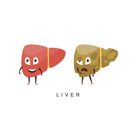 Healthy vs Unhealthy Liver Infographic Illustration.Humanized Human Organs Childish Cartoon Characters On White Background Stock Photo - Budget Royalty-Free & Subscription, Code: 400-08712109