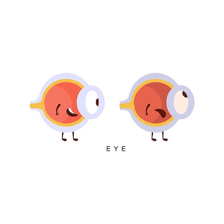 Healthy vs Unhealthy Eye Infographic Illustration.Humanized Human Organs Childish Cartoon Characters On White Background Stock Photo - Budget Royalty-Free & Subscription, Code: 400-08712117