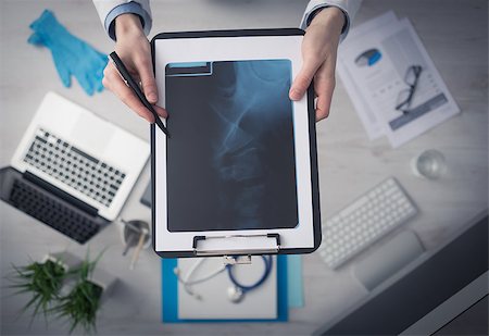 simsearch:400-08751444,k - Radiologist cheching an x-ray image of human spine, hands and clipboard close up with desktop on background, top view Photographie de stock - Aubaine LD & Abonnement, Code: 400-08749509