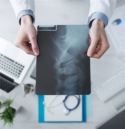 simsearch:400-08751444,k - Radiologist cheching an x-ray image of human spine, hands close up with desktop on background, top view Photographie de stock - Aubaine LD & Abonnement, Code: 400-08749510
