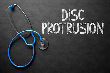 ring neck - Medical Concept: Black Chalkboard with Disc Protrusion. Medical Concept: Disc Protrusion -  Black Chalkboard with Hand Drawn Text and Blue Stethoscope. Top View. 3D Rendering. Stock Photo - Budget Royalty-Free & Subscription, Code: 400-08752939