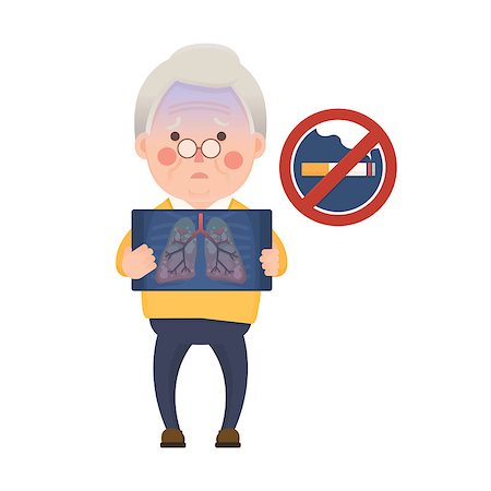 simsearch:400-08379540,k - Vector Illustration of Old Man Holding X-ray Image Showing Lung Pulmonary Emphysema Problem and No Smoking Sign, Cartoon Character Stock Photo - Budget Royalty-Free & Subscription, Code: 400-08787724