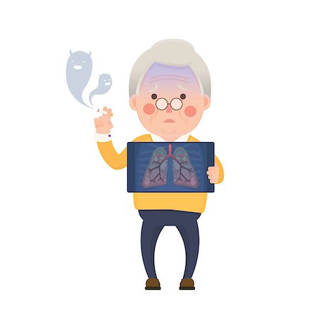simsearch:400-08379540,k - Vector Illustration of Old Man Smoking Cigarette While Holding X-ray Image Showing Lung Pulmonary Emphysema Problem, Cartoon Character, Devil Smoke Stock Photo - Budget Royalty-Free & Subscription, Code: 400-08787726