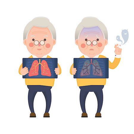simsearch:400-08379540,k - Vector Illustration of Happy Old Man Holding X-ray Image Showing Healthy Lung Compare with Sad Man Showing Lung Pulmonary Emphysema Problem, Cartoon Character Stock Photo - Budget Royalty-Free & Subscription, Code: 400-08787727