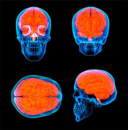 simsearch:700-00150546,k - 3d render human red brain X ray Stock Photo - Budget Royalty-Free & Subscription, Code: 400-08861555