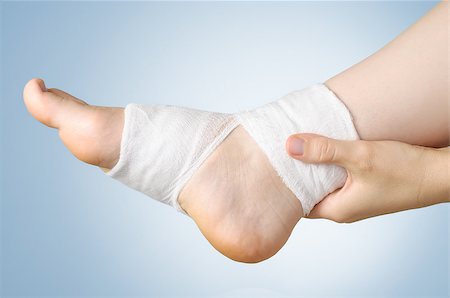 simsearch:400-07669067,k - Injured painful foot with white gauze bandage Fotografie stock - Microstock e Abbonamento, Codice: 400-08862555