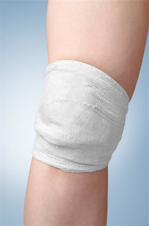 simsearch:400-07824013,k - Injured female knee with white gauze bandage Foto de stock - Royalty-Free Super Valor e Assinatura, Número: 400-08863994