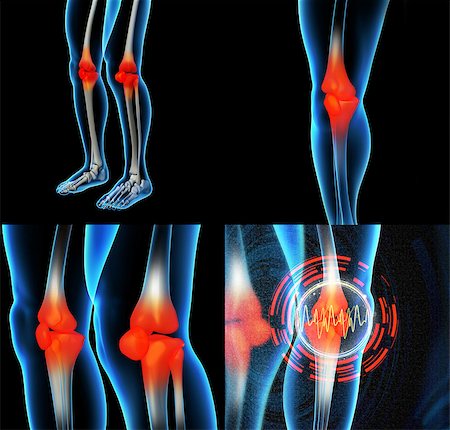 simsearch:400-07088080,k - Human knee pain with the anatomy of a skeleton leg Stock Photo - Budget Royalty-Free & Subscription, Code: 400-08889105