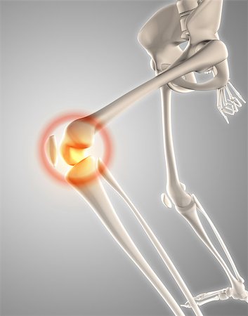 3D render of a skeleton with knee highlighted showing pain Stock Photo - Budget Royalty-Free & Subscription, Code: 400-08899550