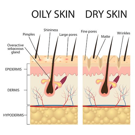 follicle - Human Skin types and conditions. Dry and oily. A diagrammatic sectional view of the skin. Also available as a Vector in Adobe illustrator EPS 10 format. Stock Photo - Budget Royalty-Free & Subscription, Code: 400-08956906