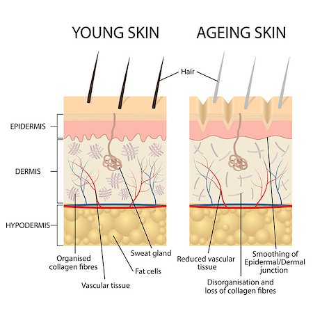 skin problem - Young healthy skin and older skin comparison, skin layers and wrinkles diagram. Also available as a Vector in Adobe illustrator EPS 10 format. Stock Photo - Budget Royalty-Free & Subscription, Code: 400-08957707