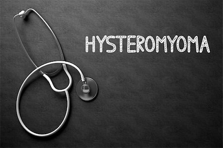 Medical Concept: Hysteromyoma - Text on Black Chalkboard with White Stethoscope. Medical Concept: Hysteromyoma Handwritten on Black Chalkboard. 3D Rendering. Stockbilder - Microstock & Abonnement, Bildnummer: 400-09010228