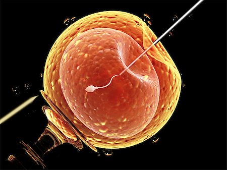 düngen - Cell injection - artificial insemination. Needle puncture the cell membrane. Spermatozoon in egg. Isolated on black background. 3d render Stockbilder - Microstock & Abonnement, Bildnummer: 400-09151560