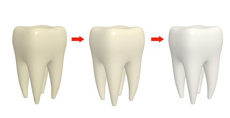 simsearch:400-06108956,k - Cleaning tooth process. Human tooth with different enamel color. Isolated on white background. 3d render Fotografie stock - Microstock e Abbonamento, Codice: 400-09151616