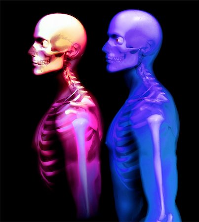An x ray image of a some man in which you can see the Skelton under the skin Stockbilder - Microstock & Abonnement, Bildnummer: 400-03908465