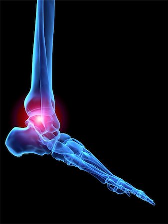 3d rendered x-ray illustration of a human skeletal foot with pain Stock Photo - Budget Royalty-Free & Subscription, Code: 400-03966338