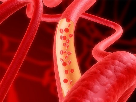 3d rendered illustration of arteries with streaming blood Stockbilder - Microstock & Abonnement, Bildnummer: 400-03966351