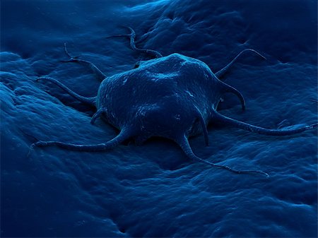3d rendered close up of a cancer cell Stock Photo - Budget Royalty-Free & Subscription, Code: 400-03966657