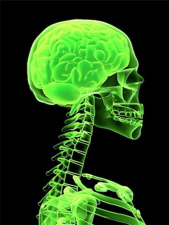 simsearch:400-05369423,k - 3d rendered x-ray illustration of a human head with brain Stockbilder - Microstock & Abonnement, Bildnummer: 400-03966709