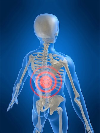 simsearch:400-04008303,k - 3d rendered anatomy illustration of a human skeletal back with pain Stockbilder - Microstock & Abonnement, Bildnummer: 400-03967219