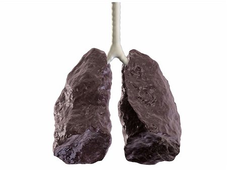 3d rendered anatomy illustration of a bad smoker lung Stock Photo - Budget Royalty-Free & Subscription, Code: 400-03961351