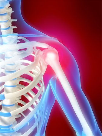 simsearch:400-04163427,k - 3d rendered anatomy illustration of a human skeletal shoulder with pain Stockbilder - Microstock & Abonnement, Bildnummer: 400-03962342