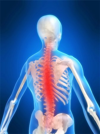 simsearch:400-04163427,k - 3d rendered anatomy illustration of a human skeleton with a painful spine Stockbilder - Microstock & Abonnement, Bildnummer: 400-03962520