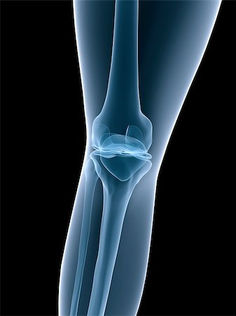 simsearch:400-07088080,k - 3d rendered x-ray illustration of a human knee Stock Photo - Budget Royalty-Free & Subscription, Code: 400-03979545