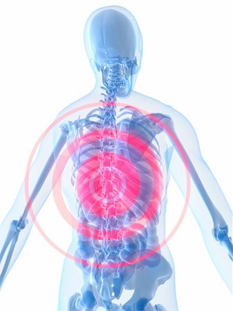 simsearch:400-04008303,k - 3d rendered anatomy illustration of a human skeleton with pain in the spine Stockbilder - Microstock & Abonnement, Bildnummer: 400-03973329