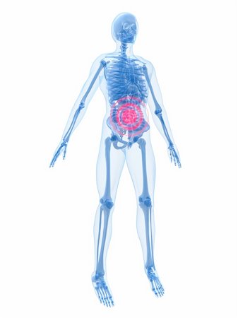 simsearch:400-04163427,k - 3d rendered anatomy illustration of a human skeleton with bellyache Stockbilder - Microstock & Abonnement, Bildnummer: 400-03973334