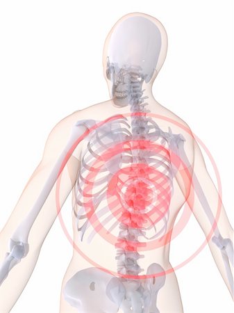simsearch:400-04163427,k - 3d rendered illustration of a human skeleton with a painful spine Stockbilder - Microstock & Abonnement, Bildnummer: 400-03973332