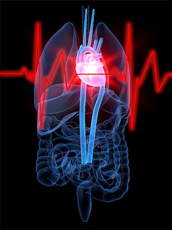 simsearch:400-04163427,k - 3d rendered anatomy illustration of human organs with a heartattack Stockbilder - Microstock & Abonnement, Bildnummer: 400-03973349