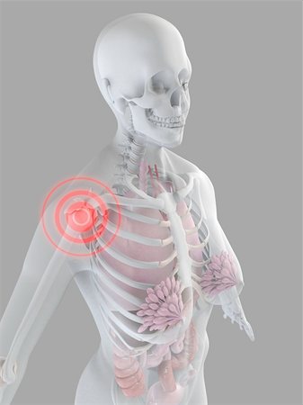 simsearch:400-04008303,k - 3d rendered anatomy illustration of a human skeleton with a painful shoulder Stockbilder - Microstock & Abonnement, Bildnummer: 400-03973506