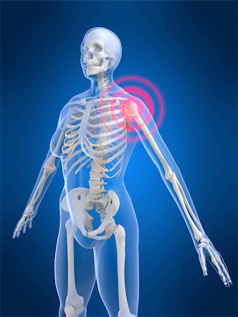simsearch:400-04163427,k - 3d rendered anatomy illustration of a female skeleton with a painful shoulder Stockbilder - Microstock & Abonnement, Bildnummer: 400-03973583