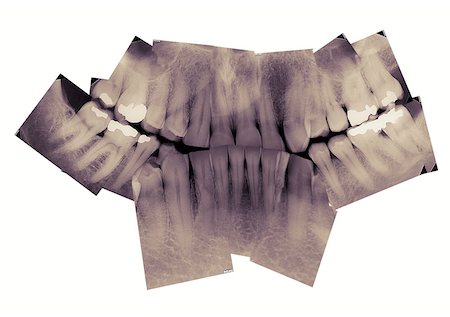 Radiographie des dents matures Photographie de stock - Premium Libres de Droits, Code: 600-05610067