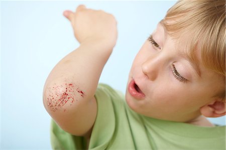 sangue - Boy with grazed elbow Fotografie stock - Premium Royalty-Free, Codice: 614-06168874