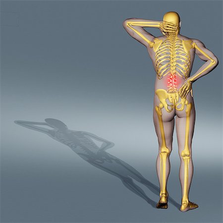 Computer-generated illustration of back pain Foto de stock - Sin royalties Premium, Código: 614-08876232