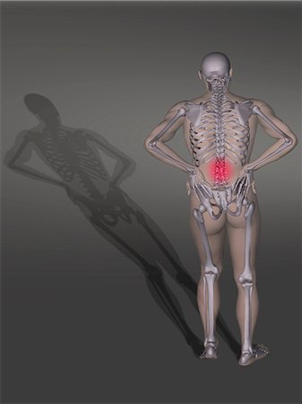 skeleton full body - Low back pain illustration Stock Photo - Premium Royalty-Free, Code: 614-08876242