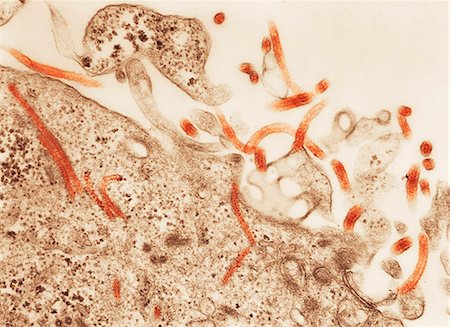 Transmission Electron micrograph of  Ebola virus Foto de stock - Sin royalties Premium, Código: 614-08870062