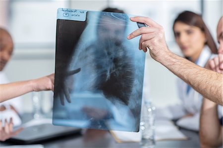 doctor looking at xray - Group of doctors sitting at table, discussion patient's x-ray Stock Photo - Premium Royalty-Free, Code: 614-09057368