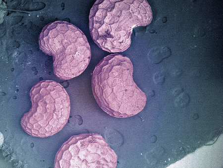 simsearch:649-09003664,k - SEM image of dried poppy seeds Photographie de stock - Premium Libres de Droits, Code: 614-09209806