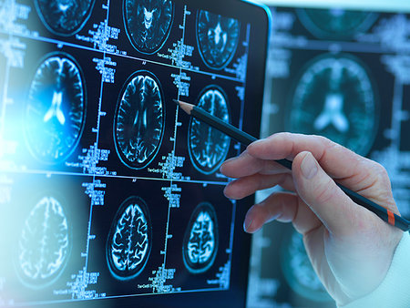 Doctor viewing brain scans for possible disease or damage in clinic Photographie de stock - Premium Libres de Droits, Code: 614-09258814