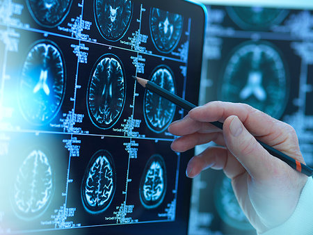 pharmaceutical research - Doctor viewing brain scans for possible disease or damage in clinic Stock Photo - Premium Royalty-Free, Code: 614-09258814