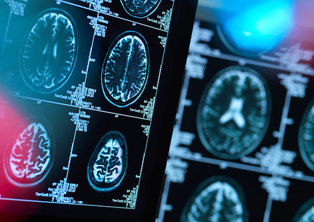 Brain scans of possible disease or damage in clinic Foto de stock - Sin royalties Premium, Código: 614-09258812