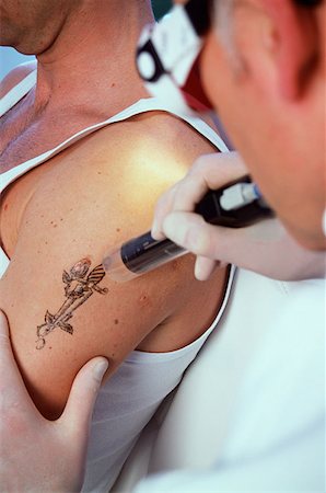 Man having tattoo removed Stock Photo - Premium Royalty-Free, Code: 614-00599688