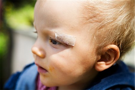 Ein kleiner Junge mit Gips im Gesicht. Stockbilder - Premium RF Lizenzfrei, Bildnummer: 6102-03751002